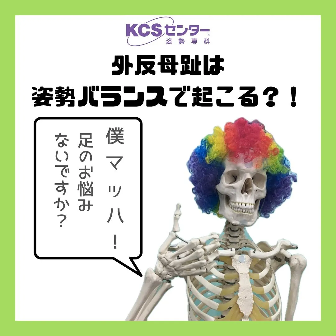 「外反母趾は姿勢バランスで起こる？！」足のお悩みないですか？