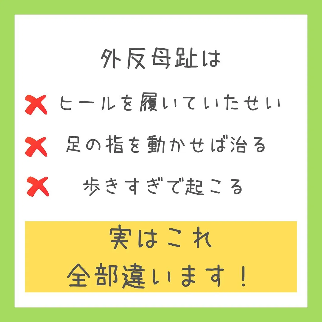 「外反母趾は姿勢バランスで起こる？！」足のお悩みないですか？