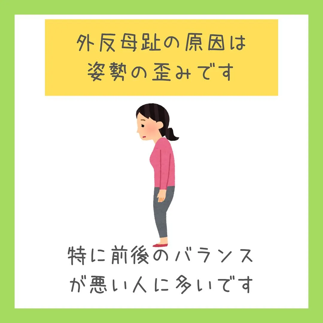 「外反母趾は姿勢バランスで起こる？！」足のお悩みないですか？
