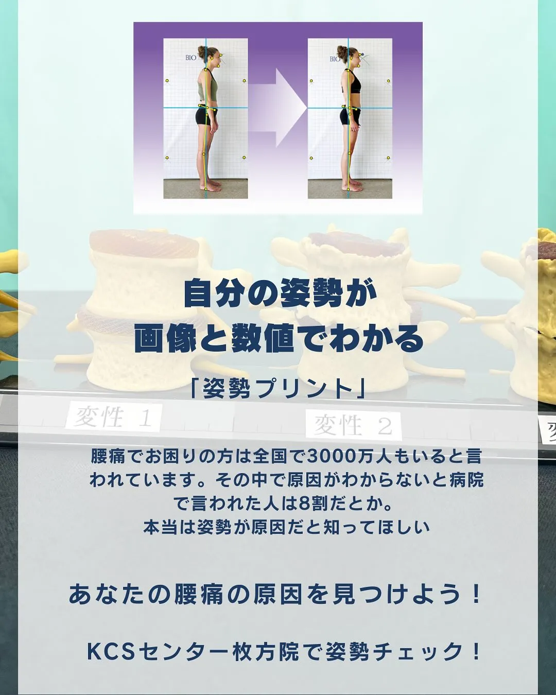 日本に3000万人もいると言われる腰痛。
