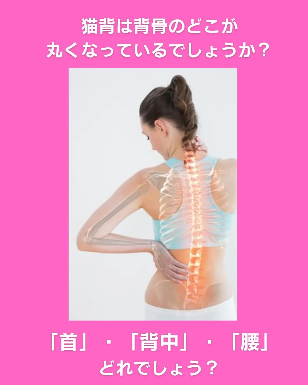 猫背ってどこが丸くなってると思いますか？