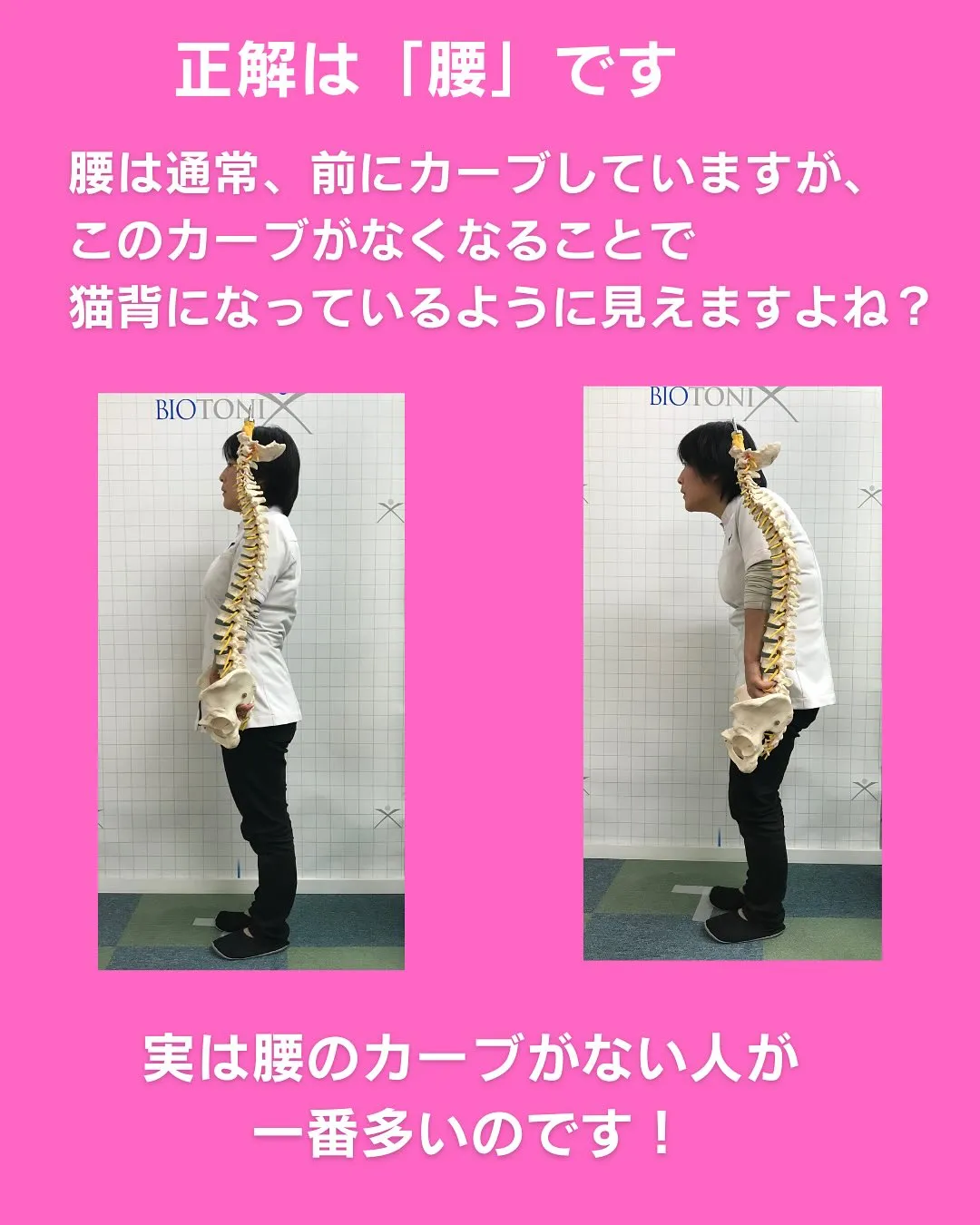 猫背ってどこが丸くなってると思いますか？